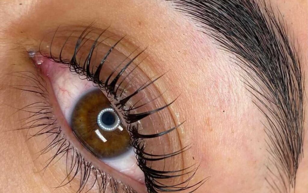 Joint Declaration Support